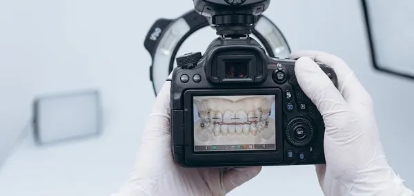 Retainer