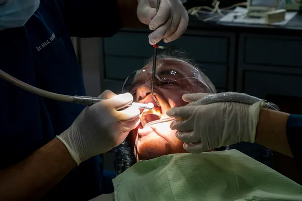 Dental implants